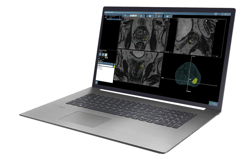 KOELIS PROMAP